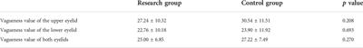 Meibomian gland morphological changes in ocular herpes zoster patients based on AI analysis